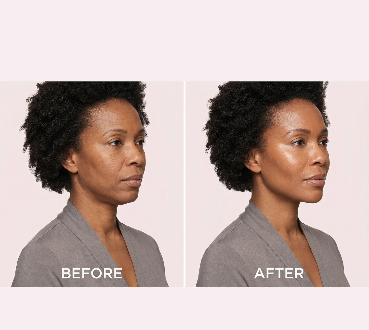 LIFTY — V-Shape Face Lifting Mask
